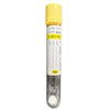 REVOLUTIONIZING URINE SAMPLE COLLECTION: THE BENEFITS OF VACUUM URINE TUBES WITH 1% BORIC ACID